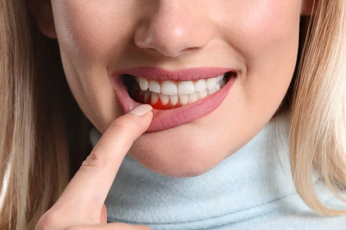 الگوریتم های کامپیوتری می توانند به ردیابی و تشخیص بیماری پریودنتال کمک کنند